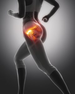 Common Causes of Hip Pain and How to Overcome It