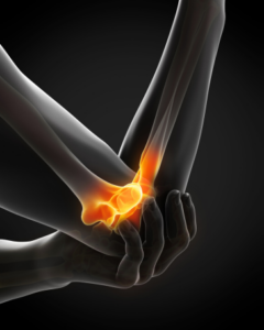 6 Causes of Chronic Elbow Pain
