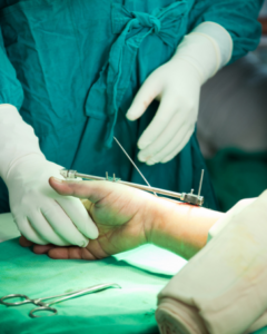 Signs You Should See an Orthopedic Surgeon in Mishawaka | Orthopedic Doctors